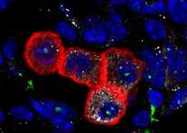 دراسة جديدة: الخلايا المناعية المسنة تزيد من نمو ورم الرئة