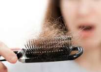 الطرق الصحيحة لعلاج تساقط الشعر