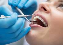 ما هي أكثر العوامل التي تؤثر على حساسية الأسنان؟