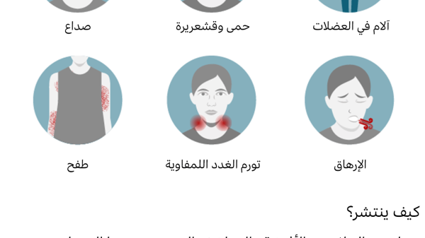 جدري القرود