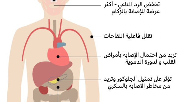 تأثير قلة النوم